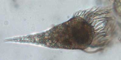 photo of a marine ciliate