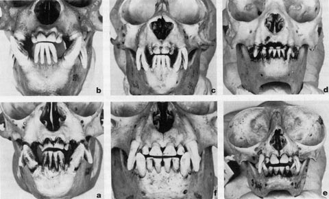 Saki Teeth Photos