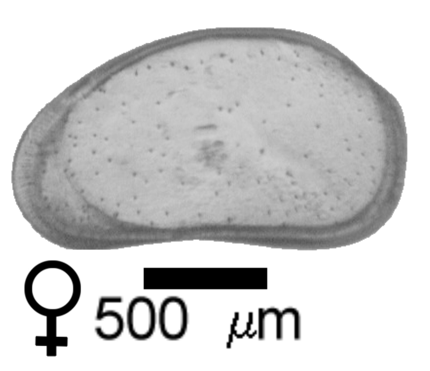 Microscope photograph of CANpatz, female