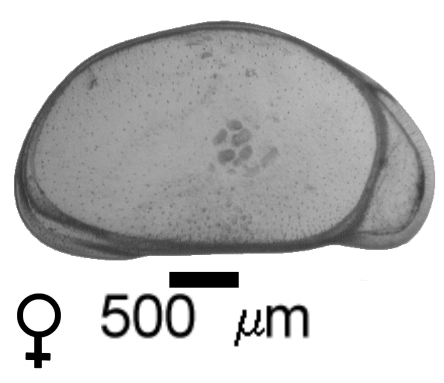 Microscope photograph of CHLAMarc, female