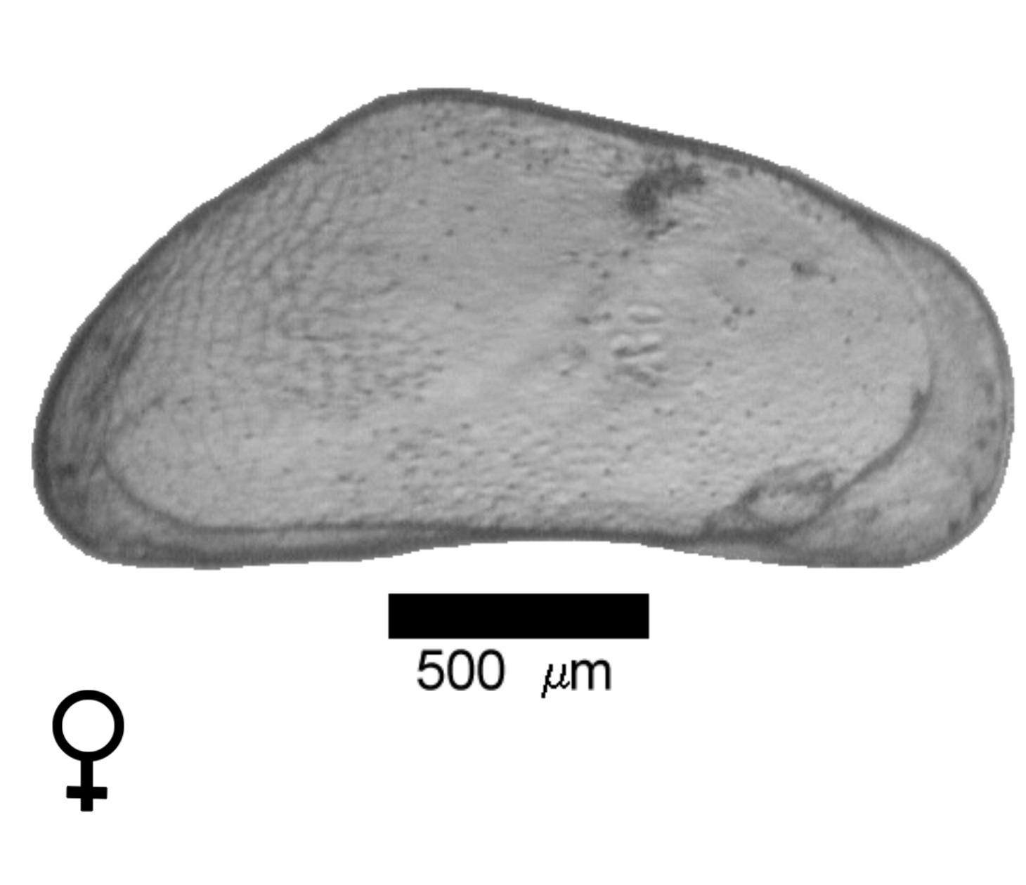 Microscope photograph of Canacum, female