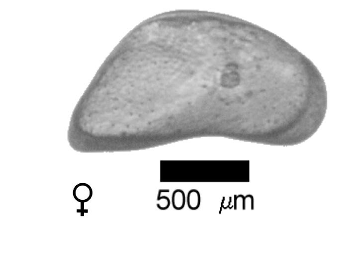 Microscope photograph of Canacutula, female