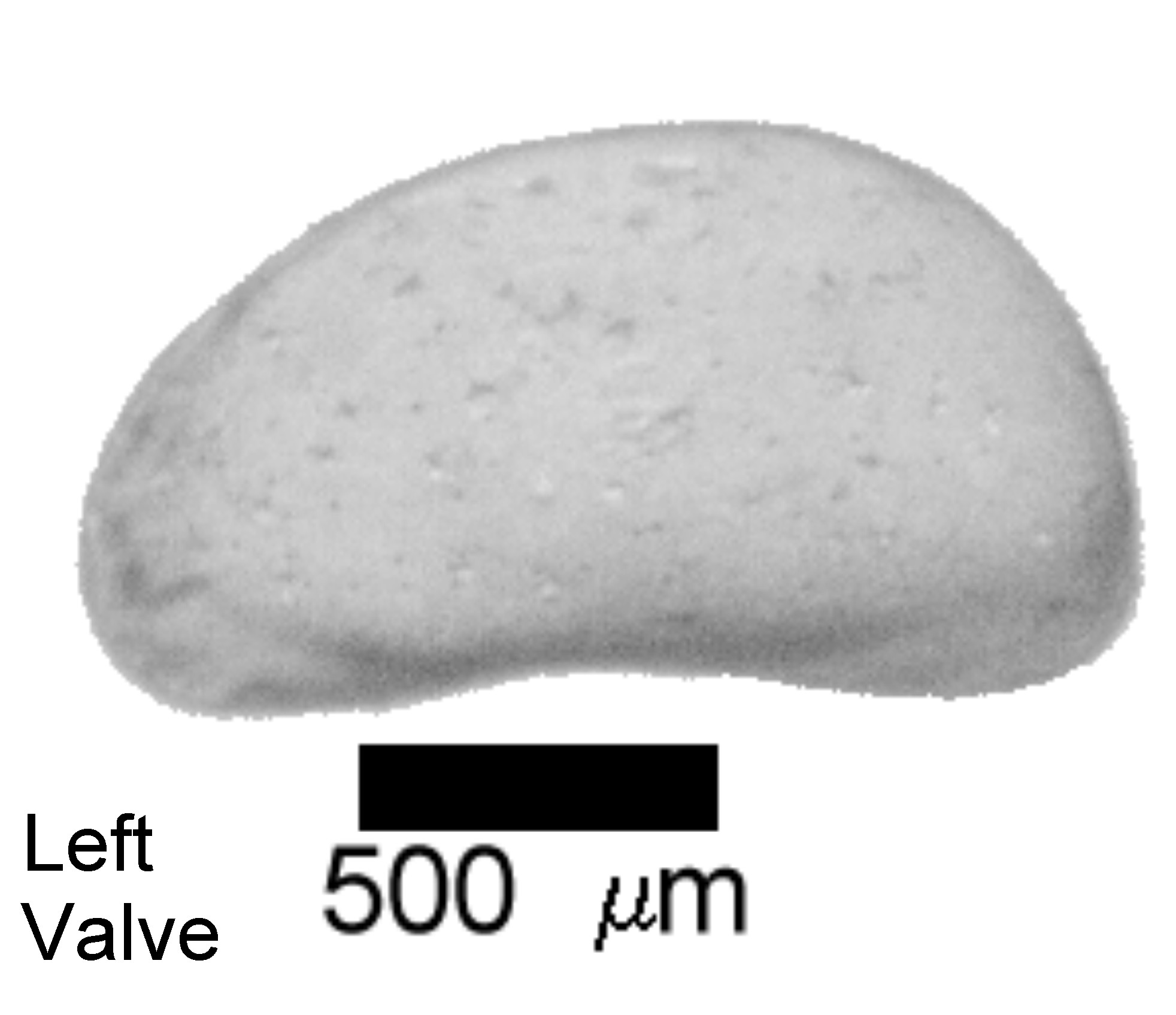 Microscope photograph of Cancan, left valve