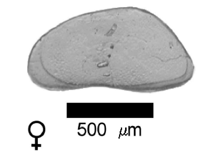 Microscope photograph of Cancrog, female