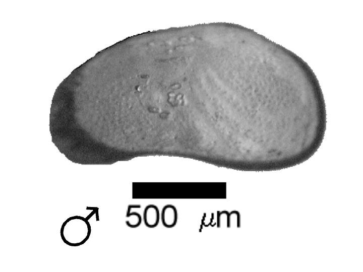 Microscope photograph of Cancrog, male