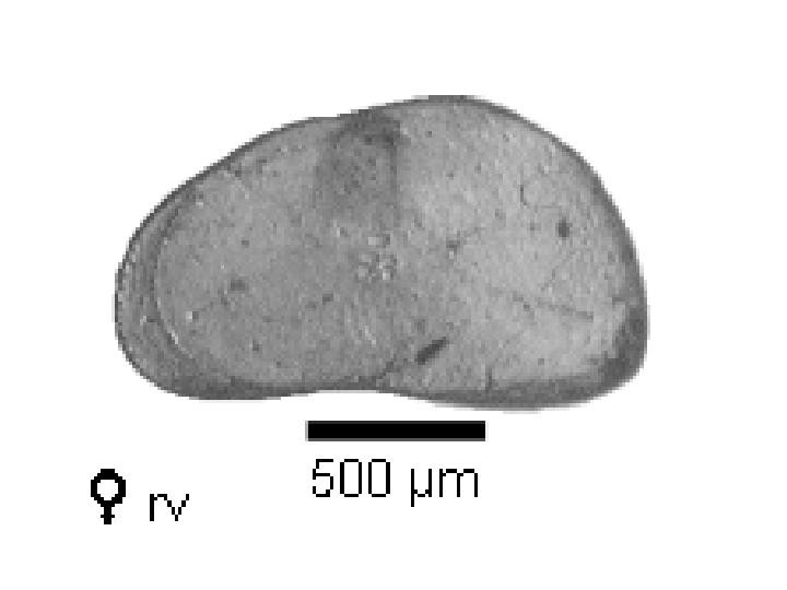 Microscope photograph of Candec, female