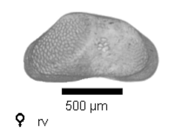 Microscope photograph of Candist, female