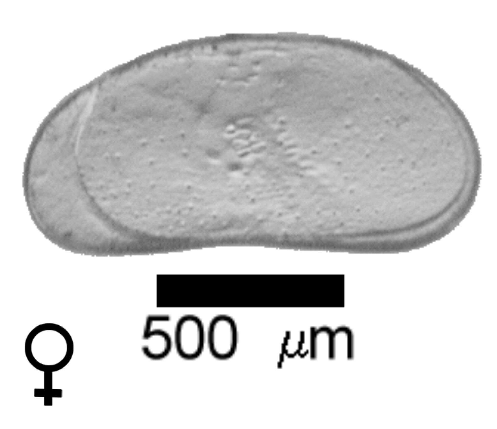 Microscope photograph of Canellip, female