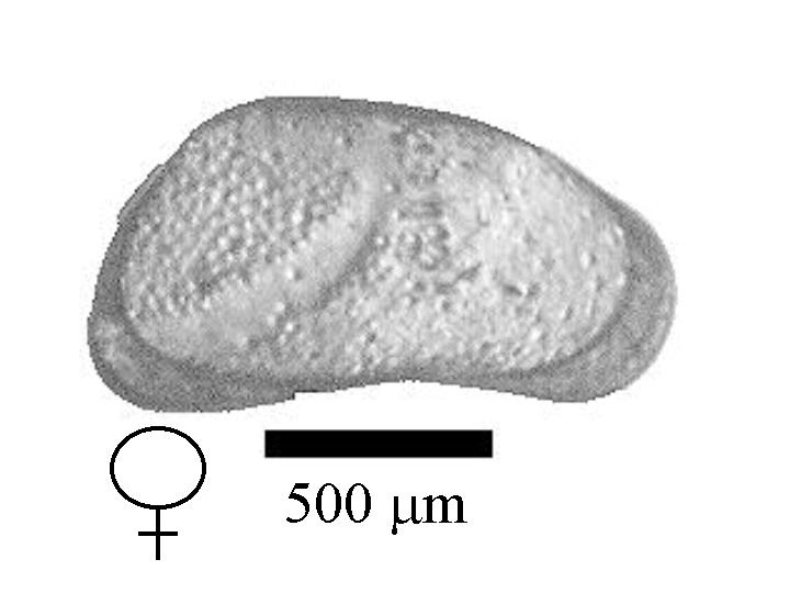 Microscope photograph of Canparaoh, female