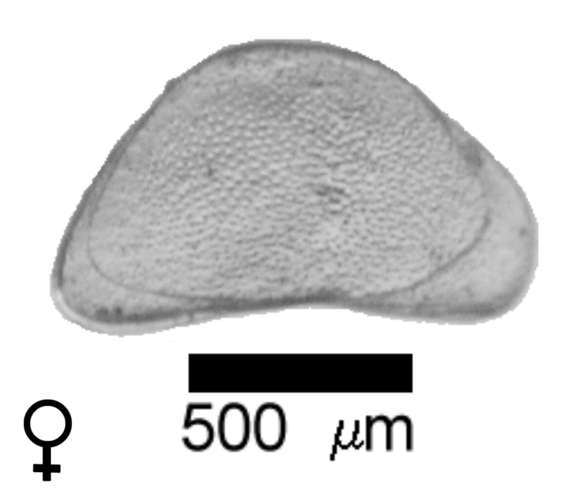 Microscope photograph of Canpunc, female