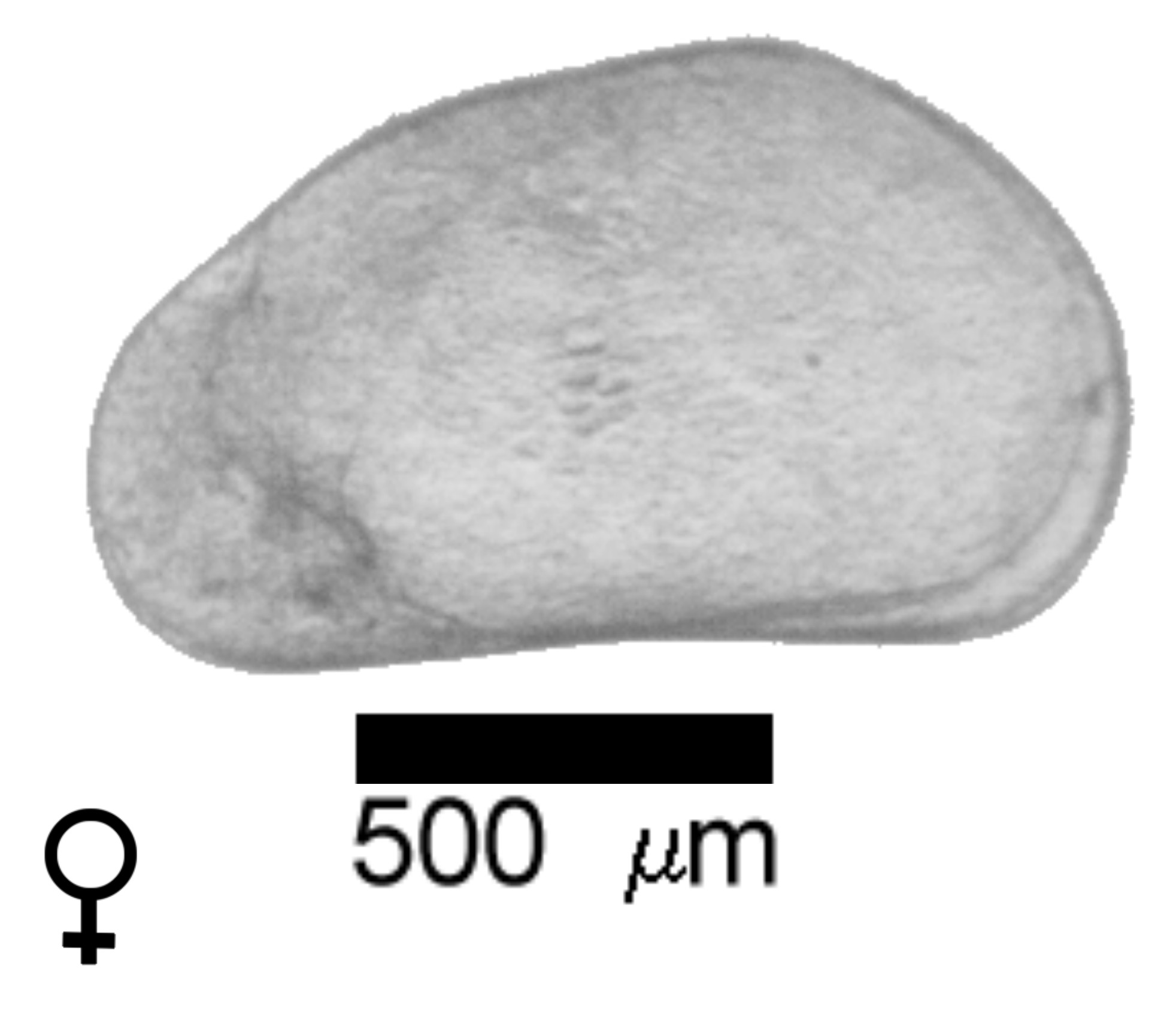 Microscope photograph of Canreno, female