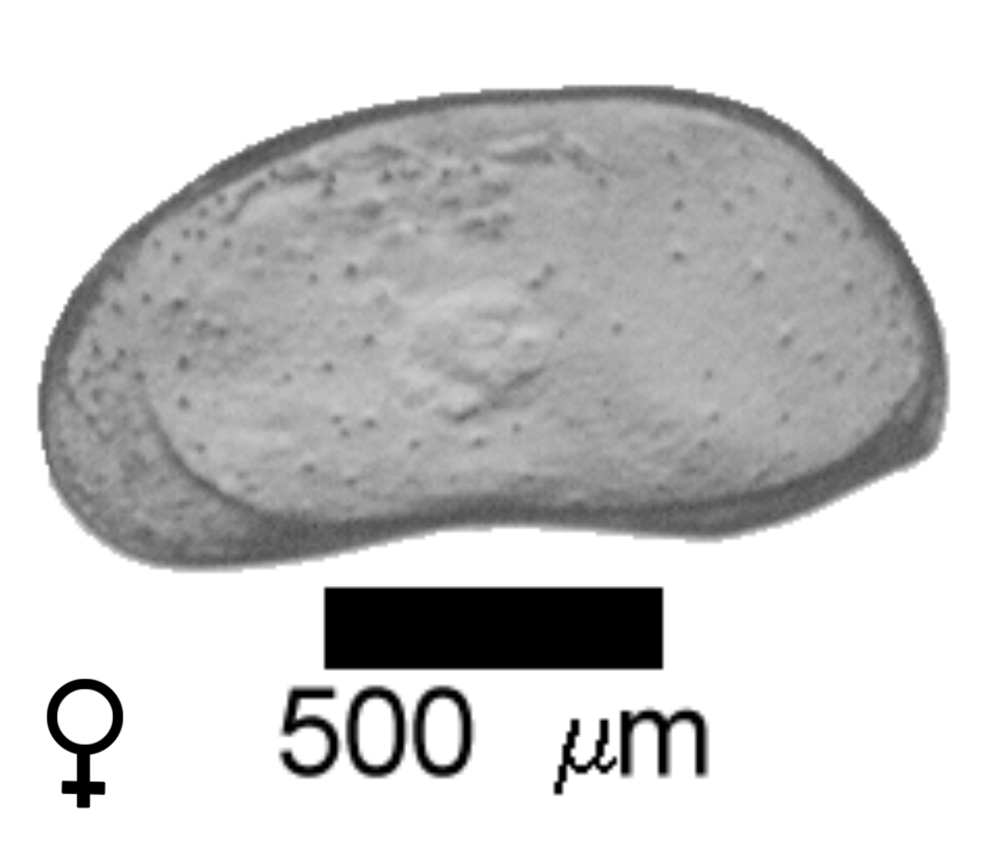 Microscope photograph of Cansig, female