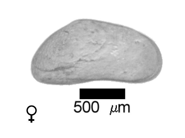 Microscope photograph of Cansubacum, female