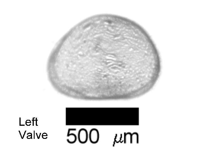 Microscope photograph of Cycloampla, left valve