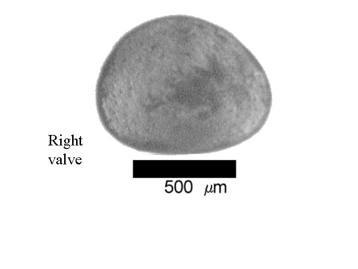 Microscope photograph of Cycloampla, right valve