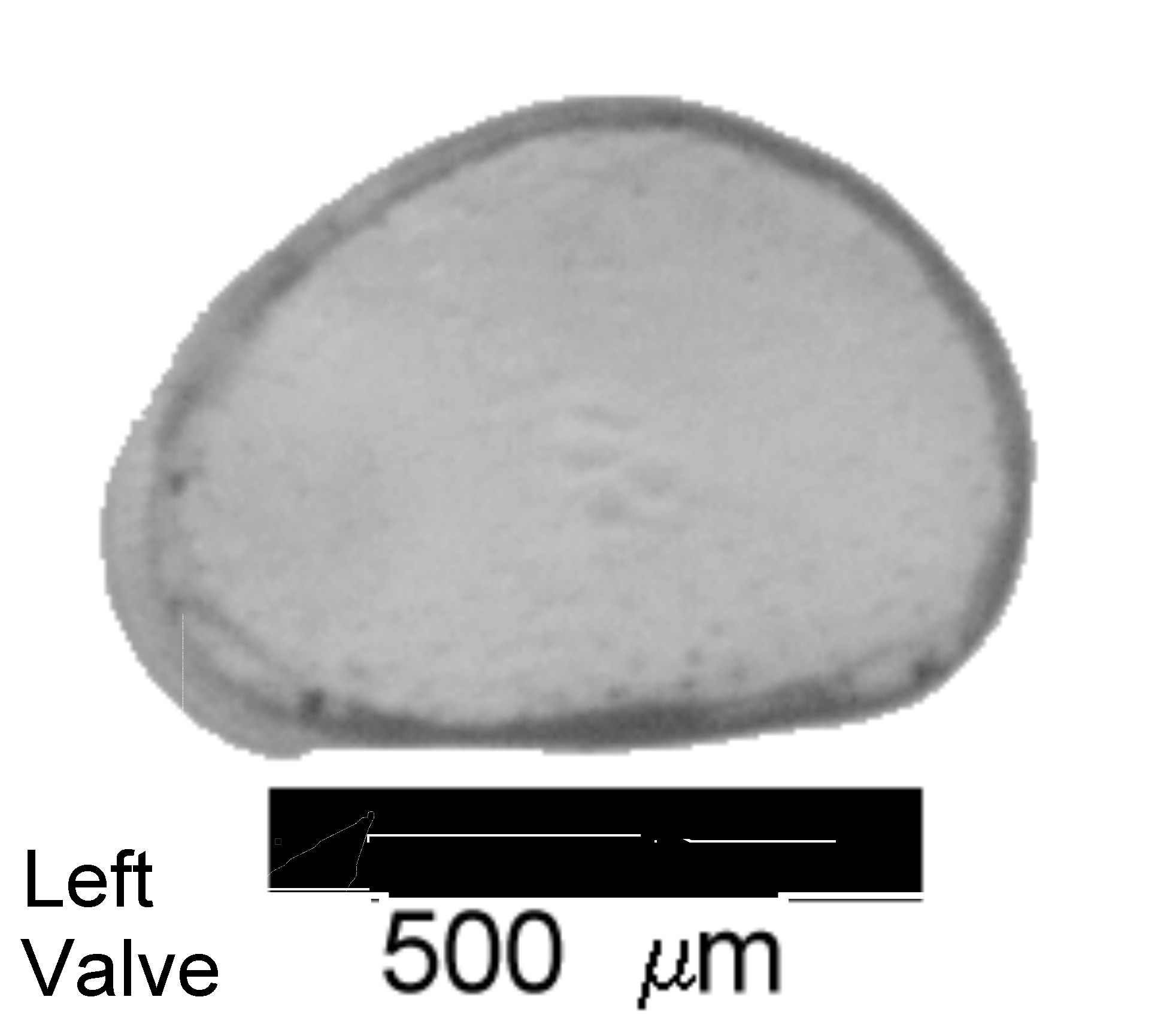 Microscope photograph of Cyclolaev, left valve