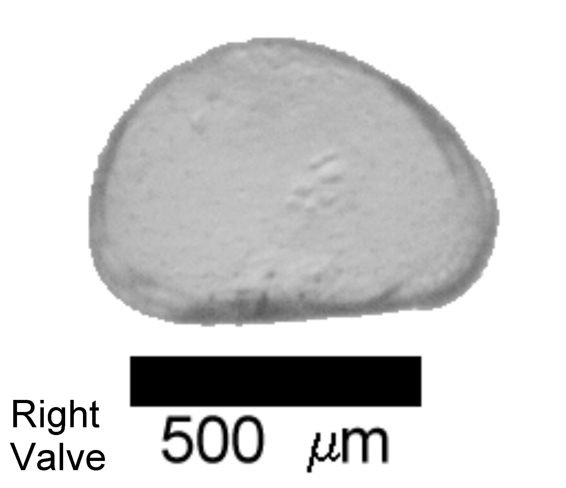 Microscope photograph of Cyclolaev, right valve