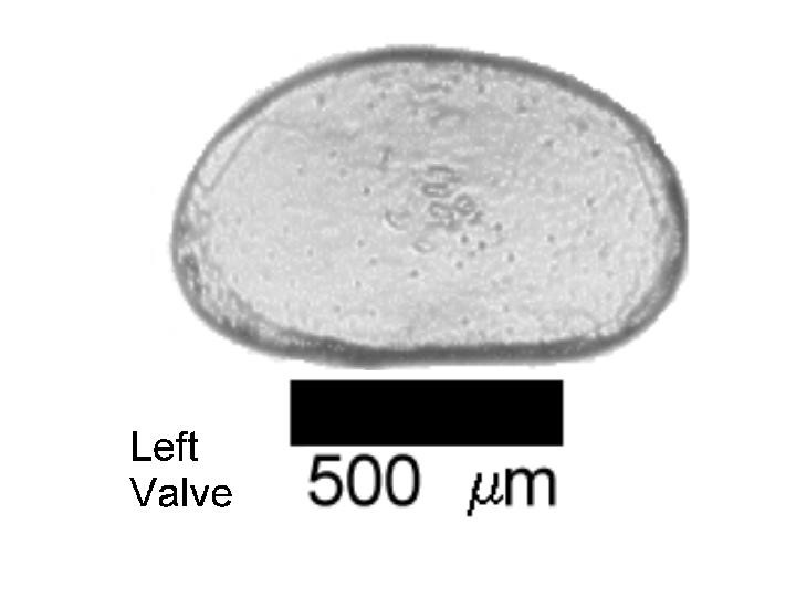 Microscope photograph of Cypriaobesa, left valve