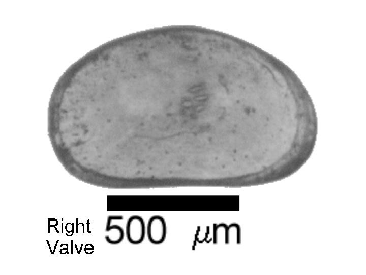 Microscope photograph of Cypriaobesa, right valve