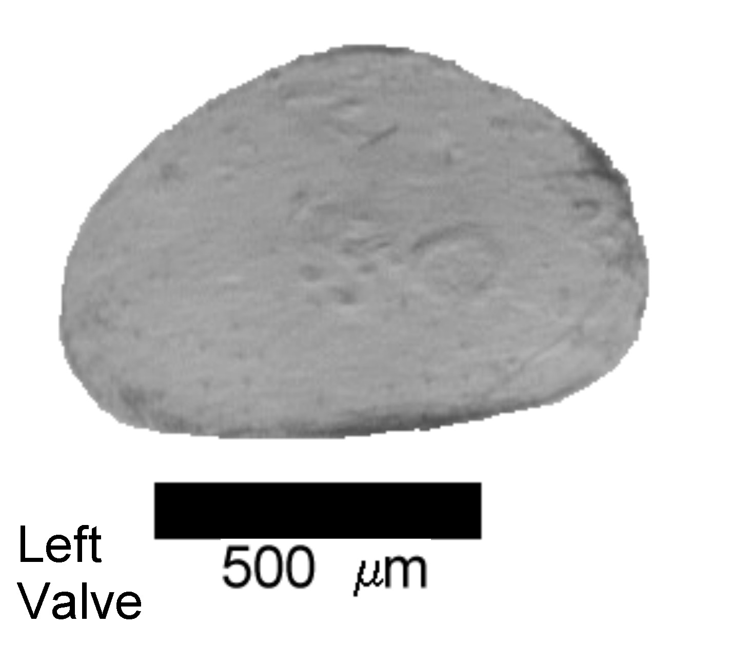 Microscope photograph of Cypriaopht, left valve