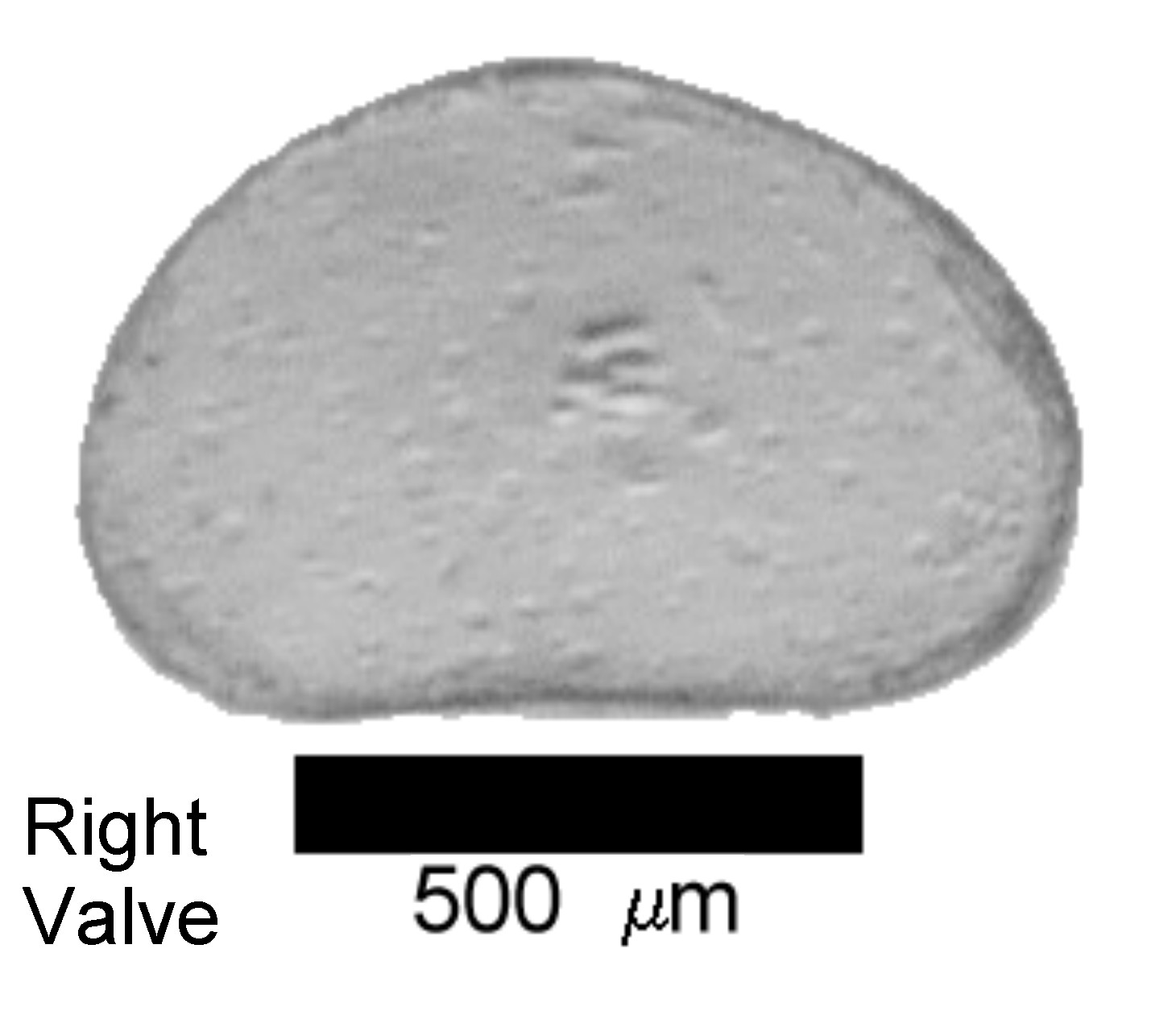 Microscope photograph of Cypriaopht, right valve