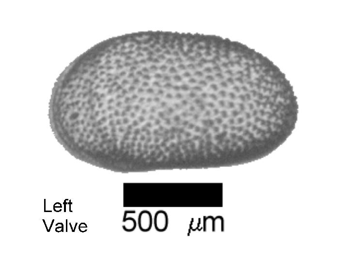 Microscope photograph of Cyprichorrid, left valve