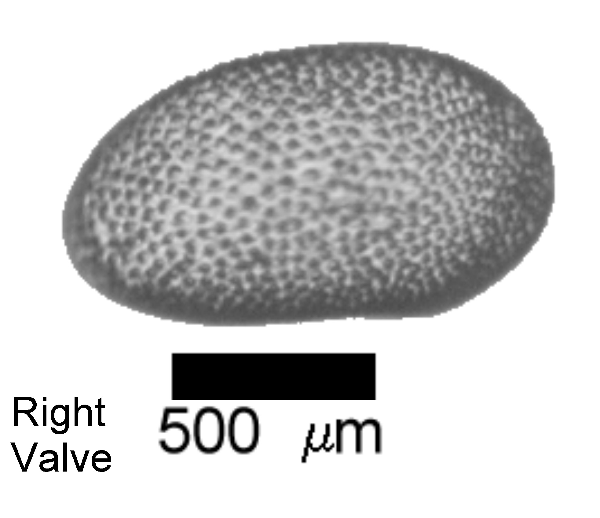 Microscope photograph of Cyprichorrid, right valve
