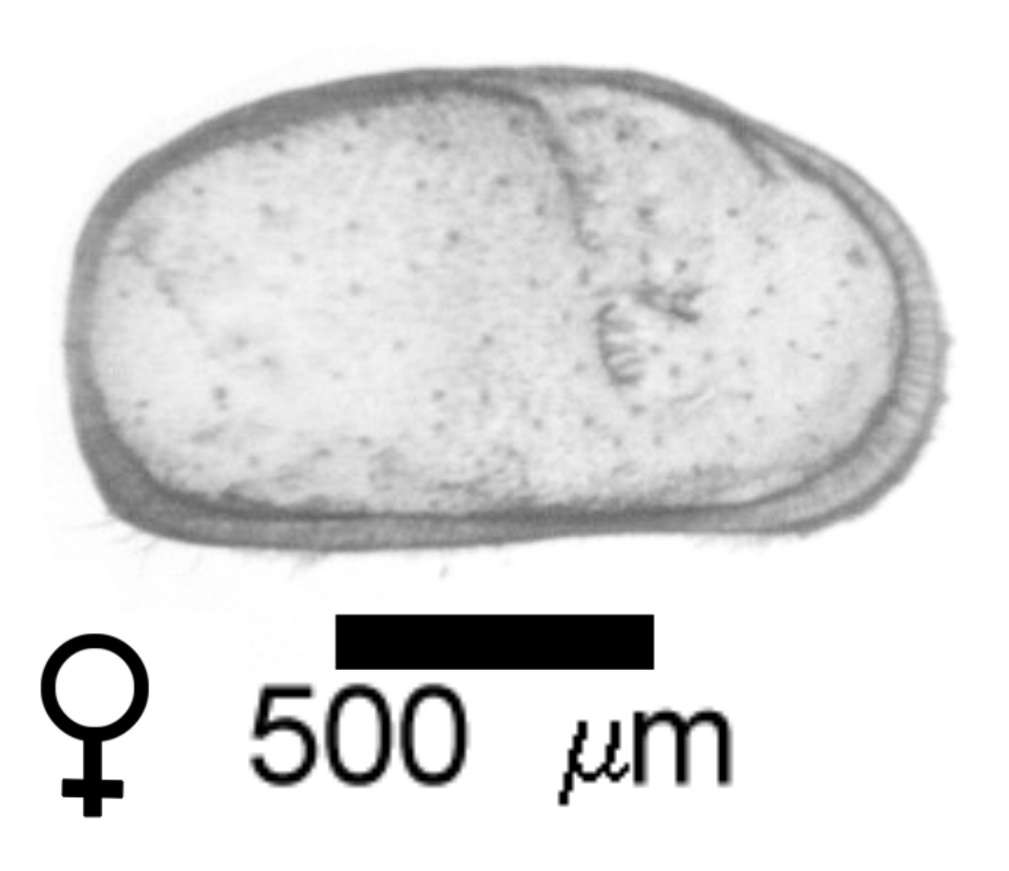 Microscope photograph of Cypridbeac, female