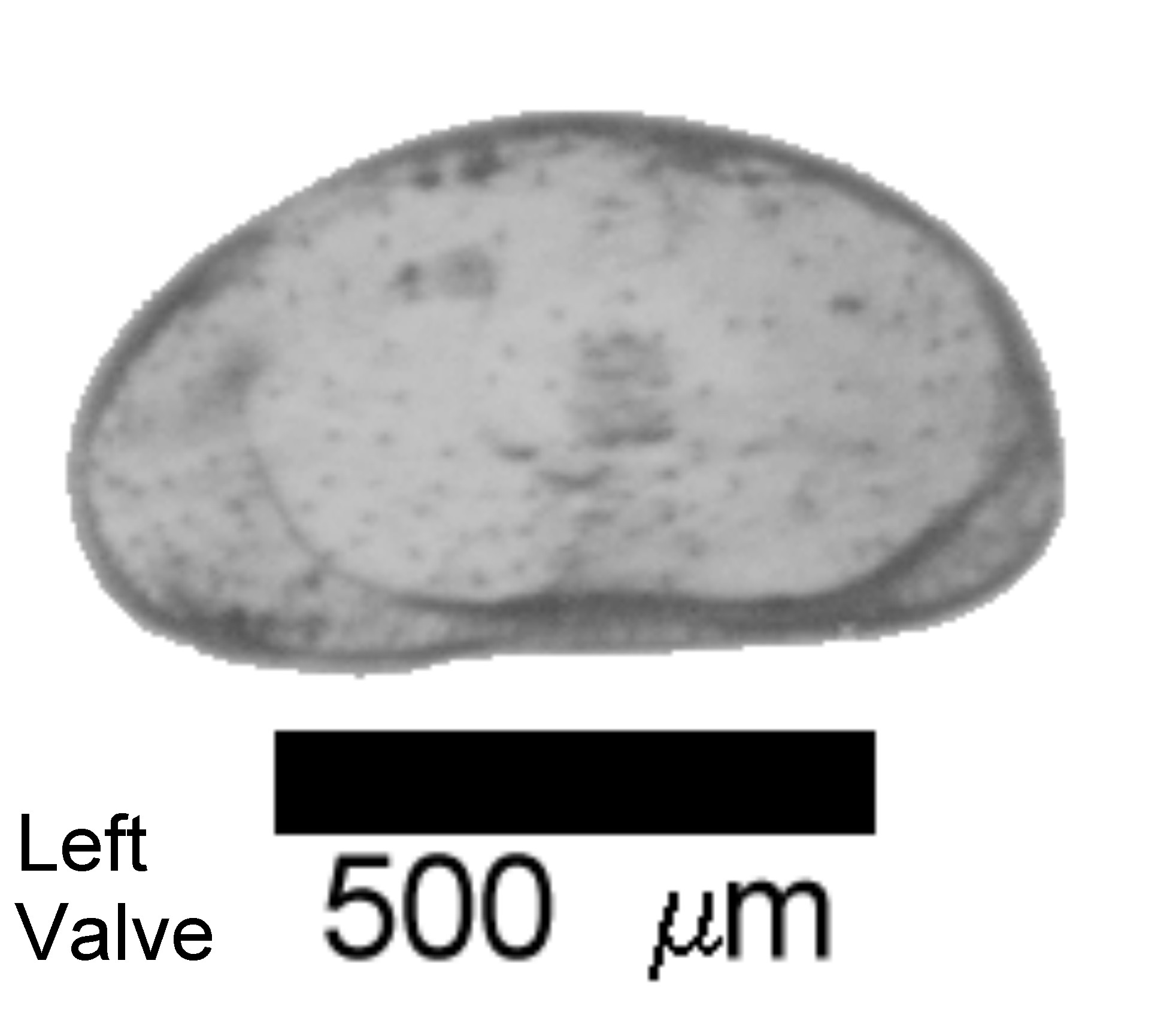 Microscope photograph of Cypridokee, left valve