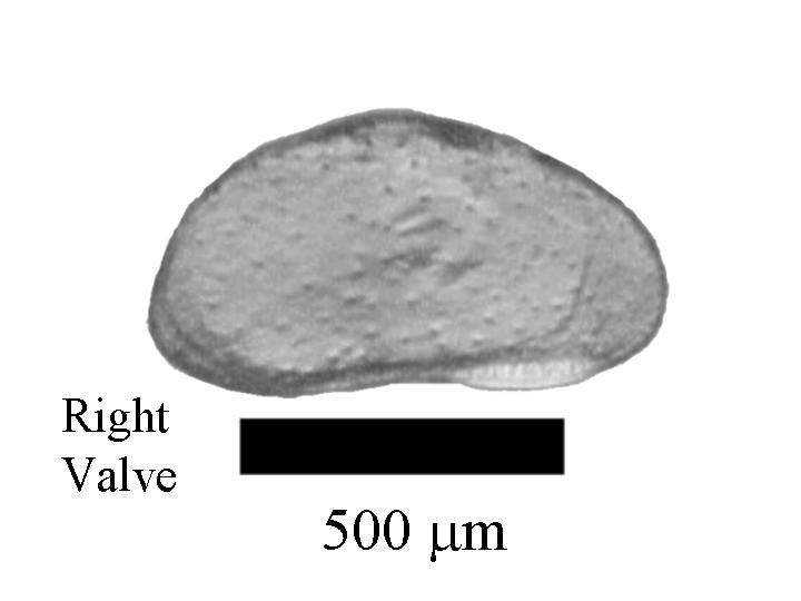 Microscope photograph of Cypridokee, right valve
