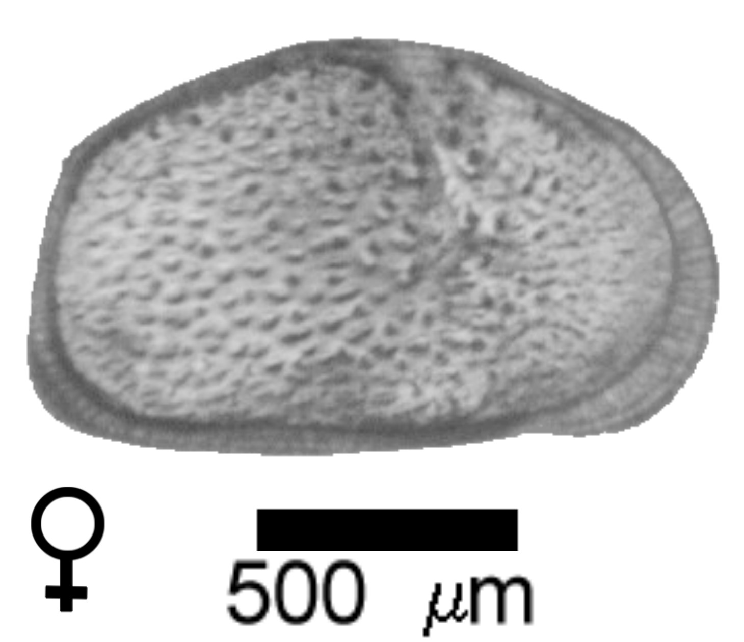 Microscope photograph of Cypridsalib, female