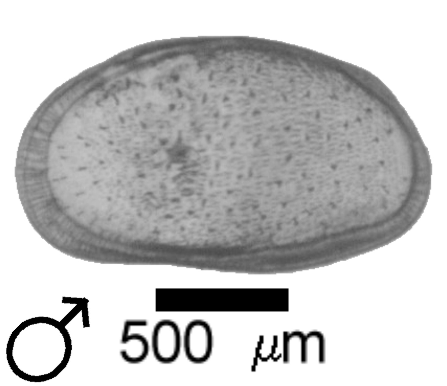 Microscope photograph of Cypridsalib, male