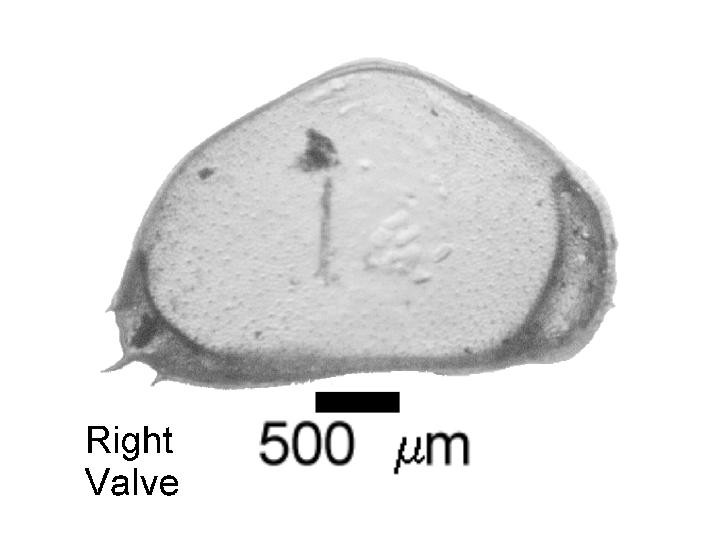 Microscope photograph of Cyprispub, right valve