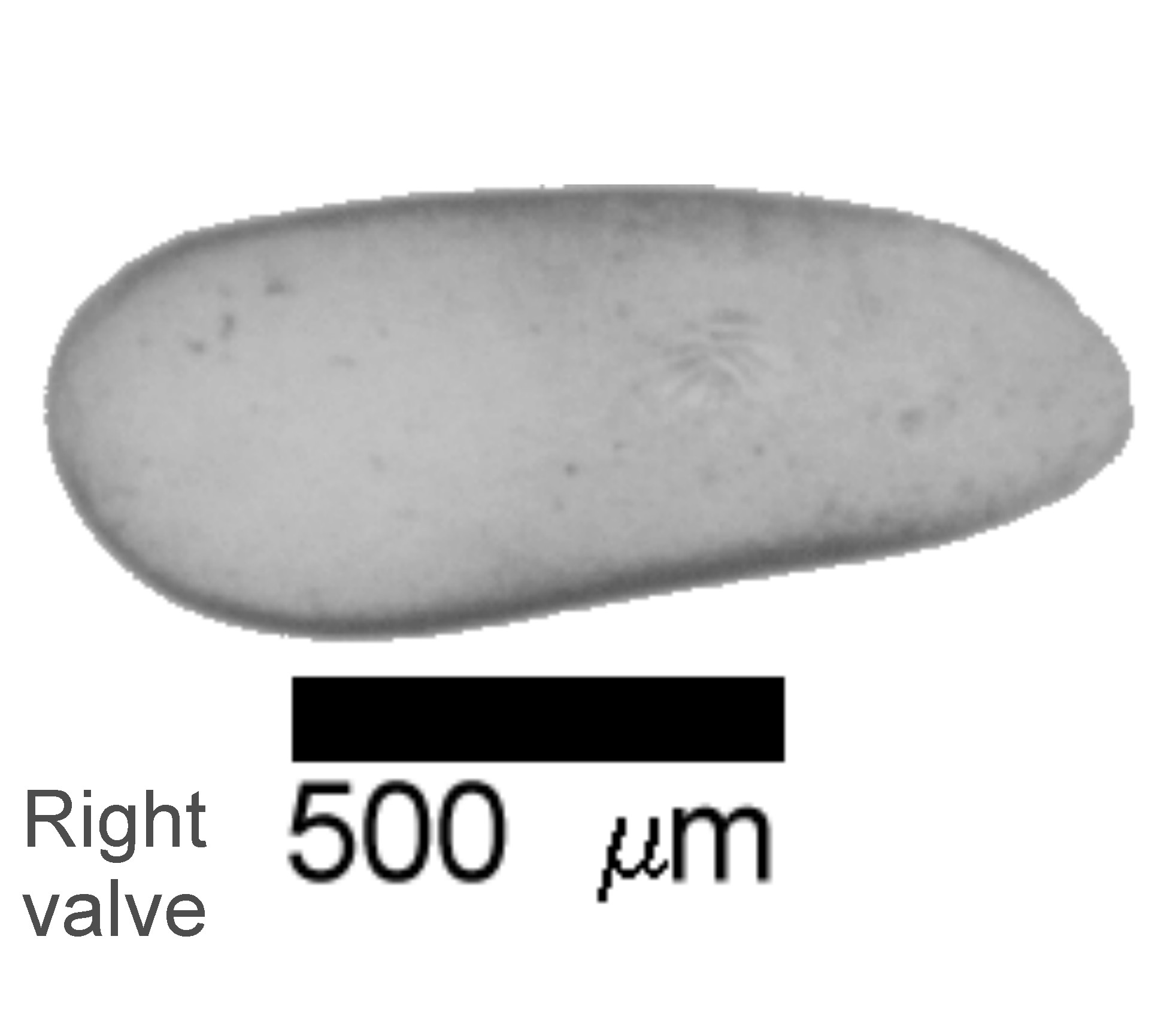 Microscope photograph of Darste, right valve