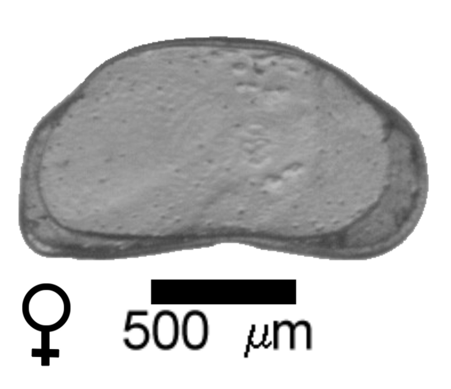 Microscope photograph of FABweg, female