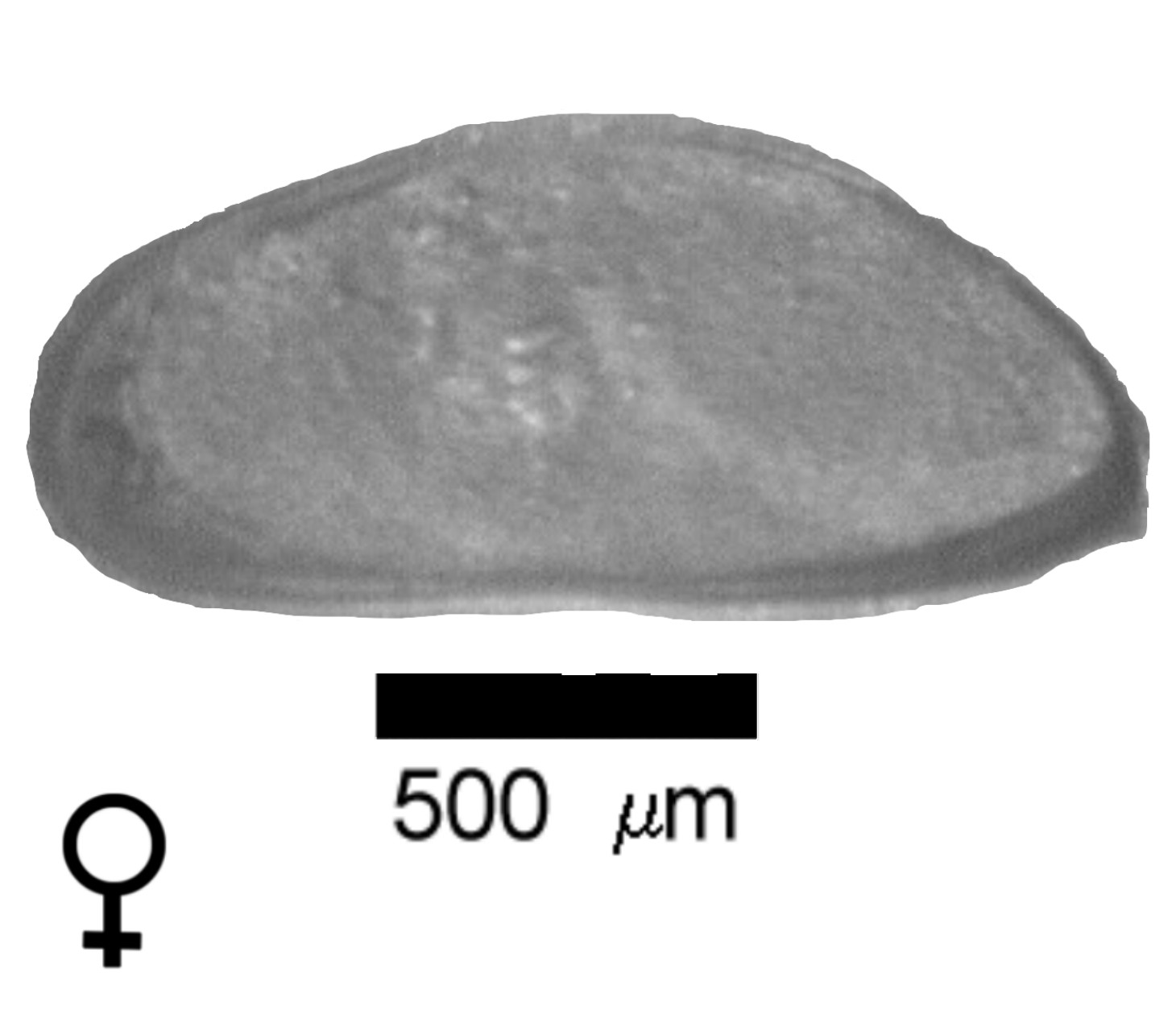 Microscope photograph of Fabbala, female