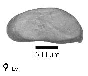 Microscope photograph of Fabcaud, female