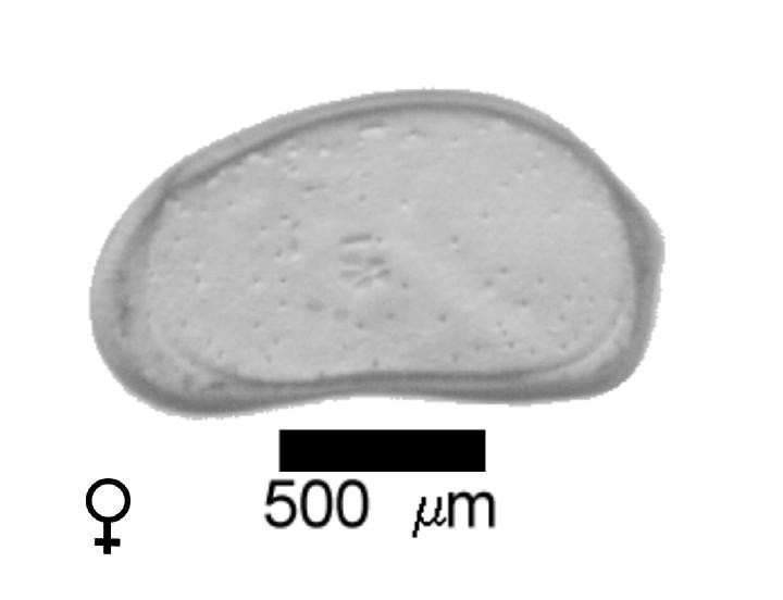 Microscope photograph of Fabraw, female