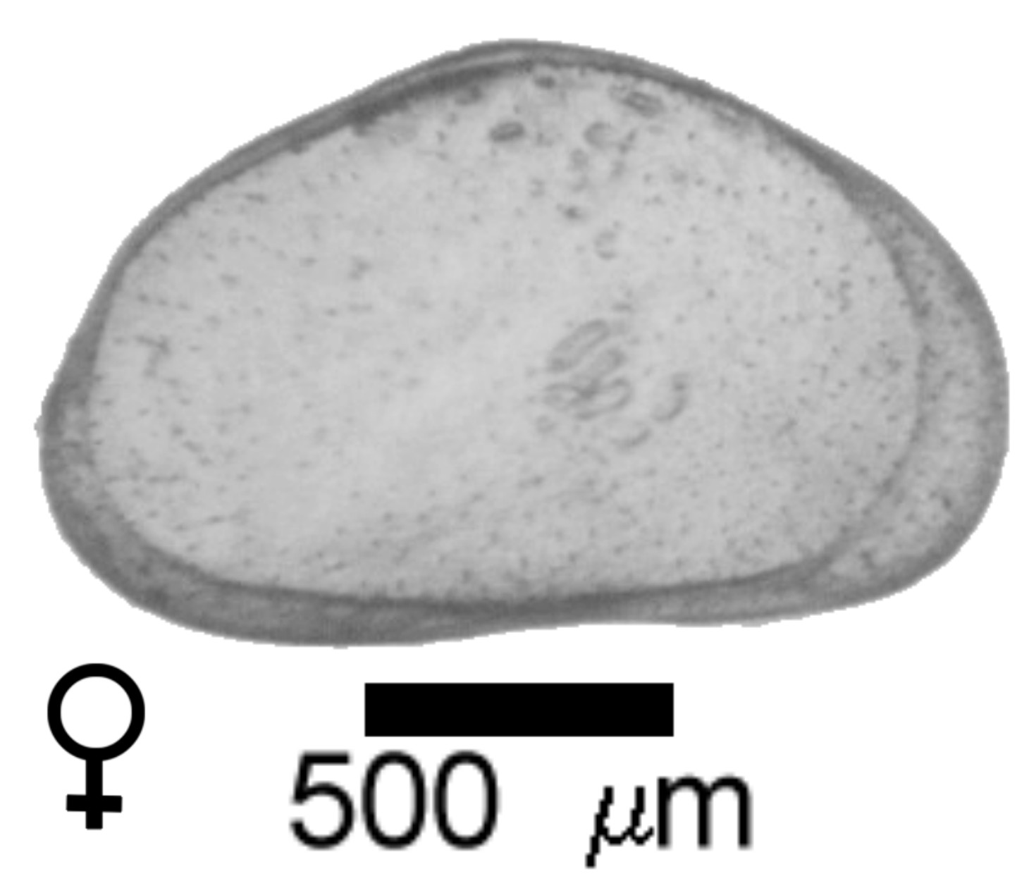 Microscope photograph of HETfret, female
