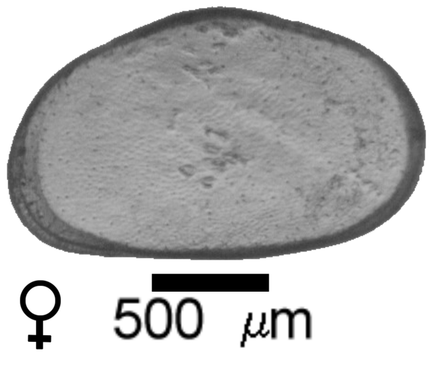 Microscope photograph of HETpunc, female