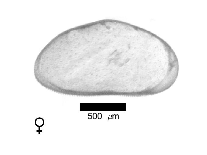 Microscope photograph of Hetantill, female
