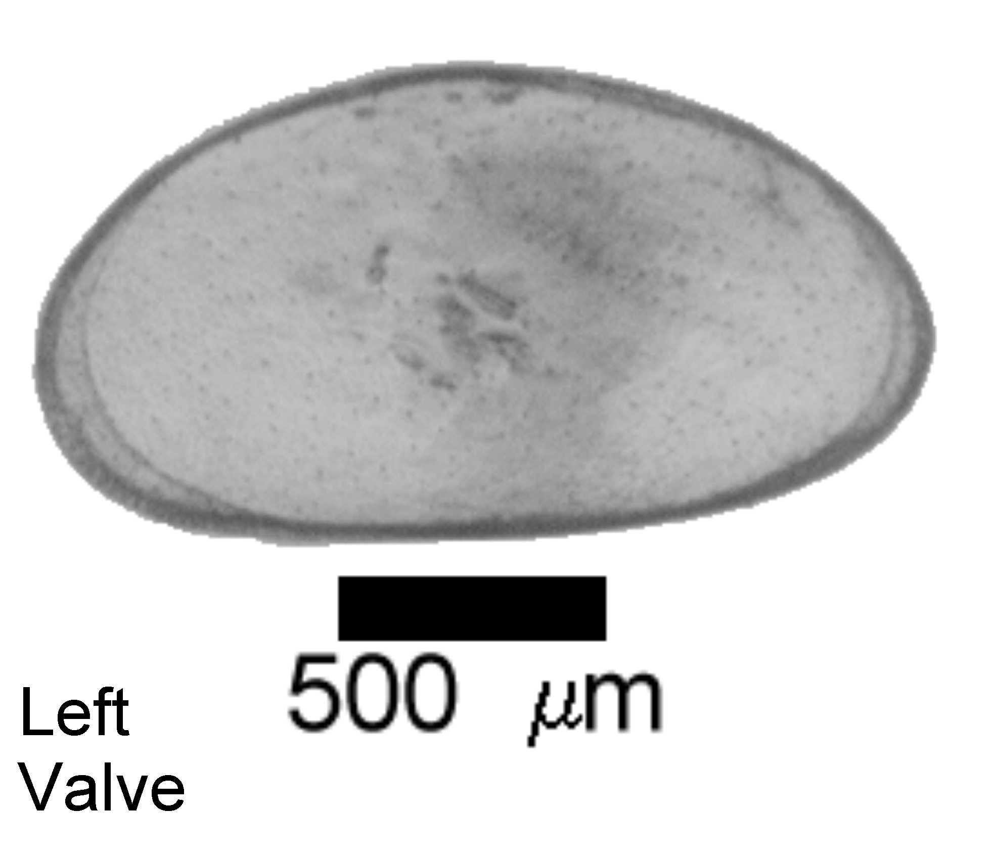Microscope photograph of Hetincon, left valve