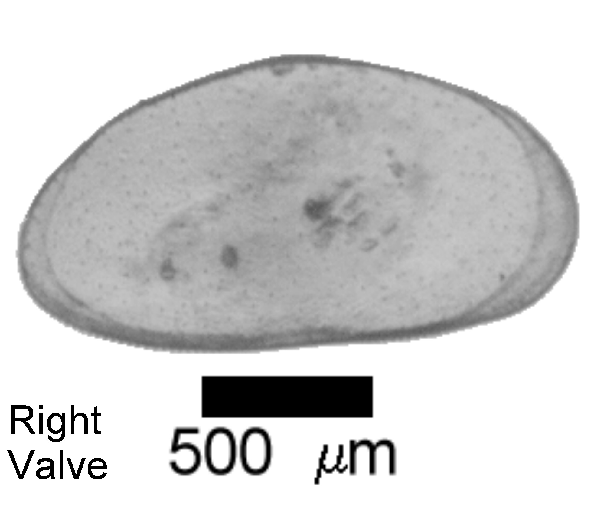 Microscope photograph of Hetincon, right valve