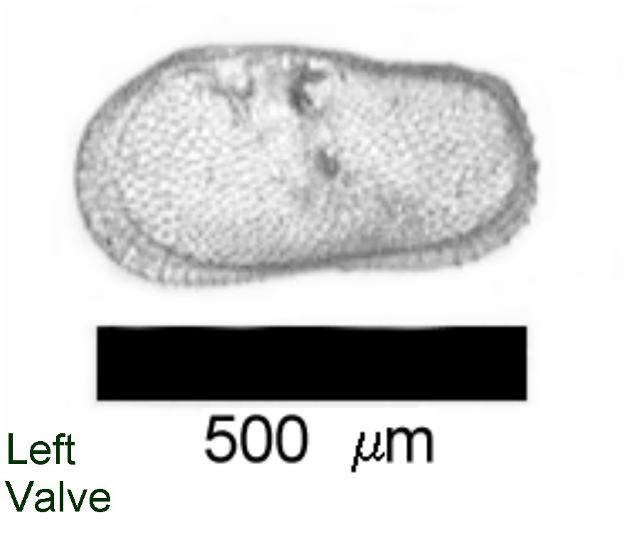 Microscope photograph of Ilygib, left valve