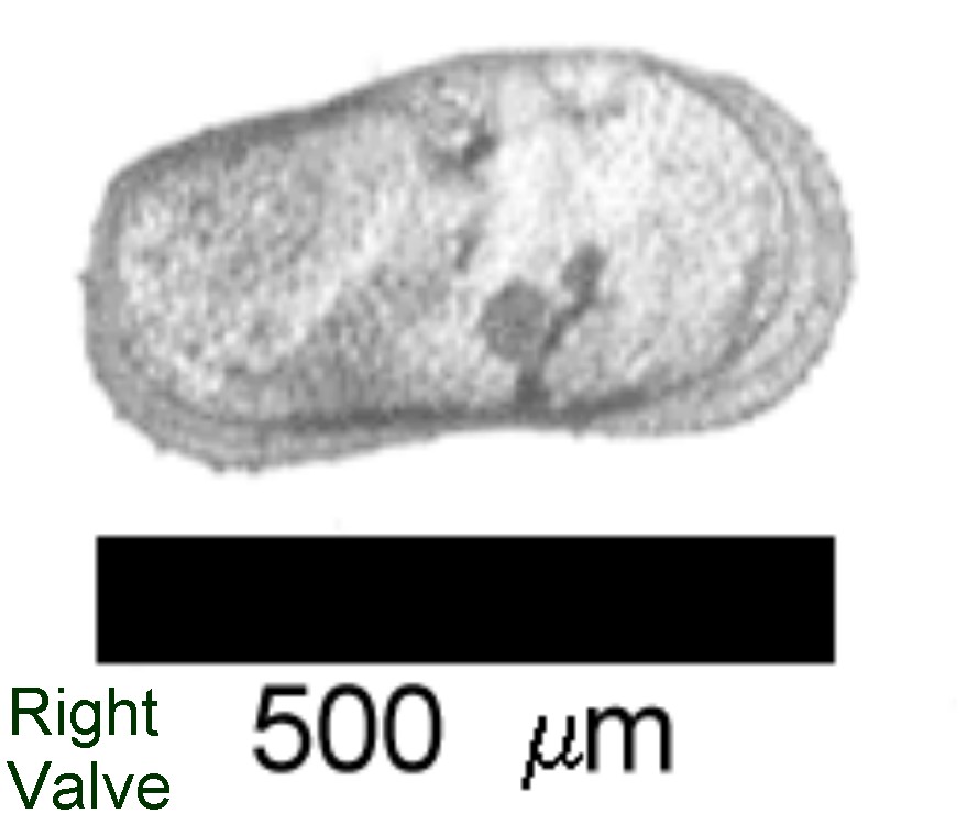 Microscope photograph of Ilygib, right valve