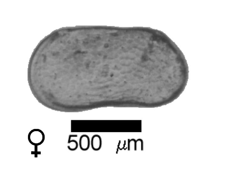 Microscope photograph of Lbrad, female