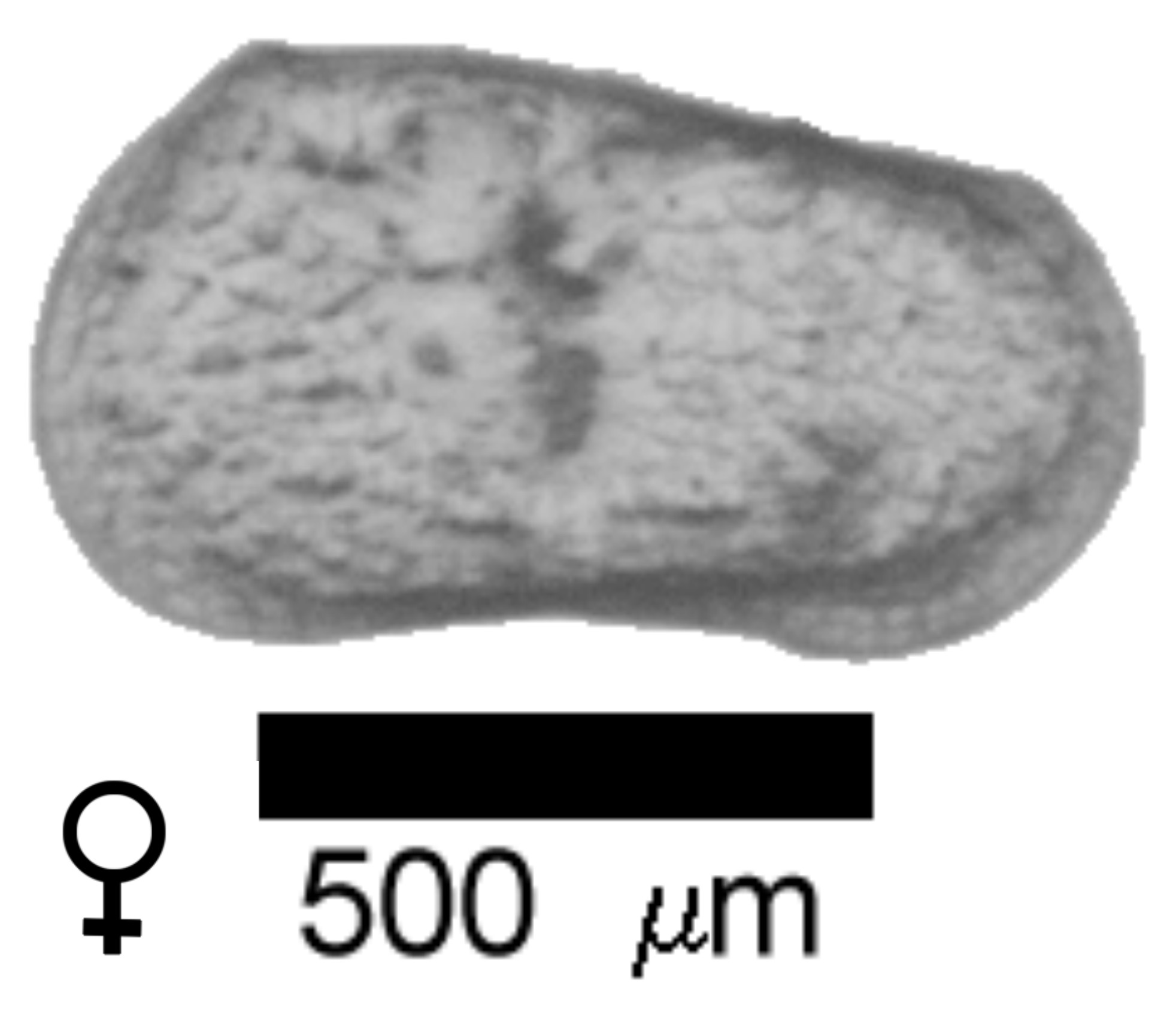 Microscope photograph of Limcerio, female