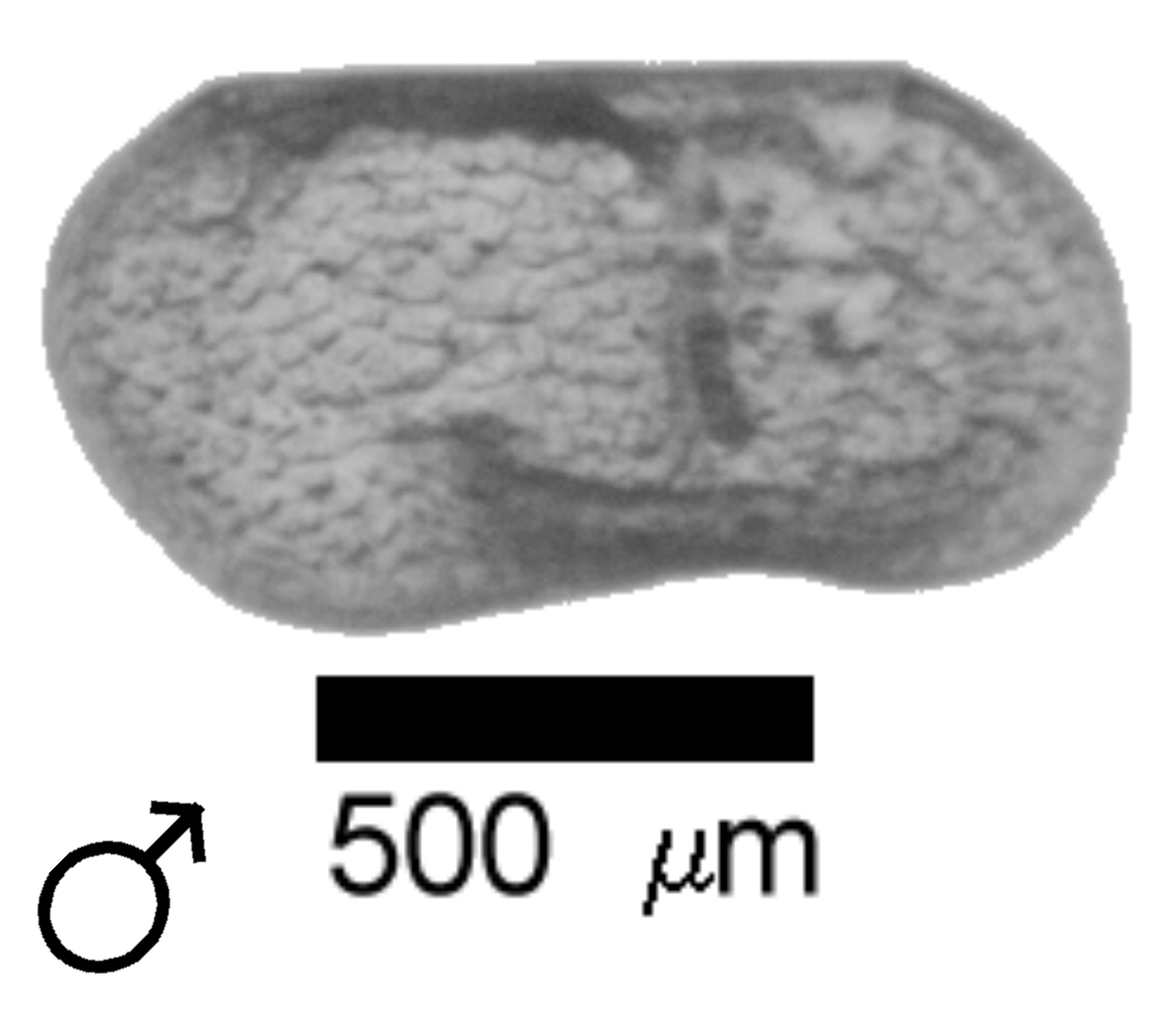 Microscope photograph of Limcerio, male