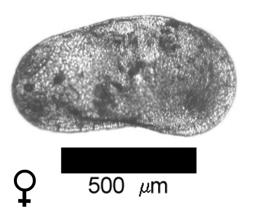 Microscope photograph of Limfriab, female