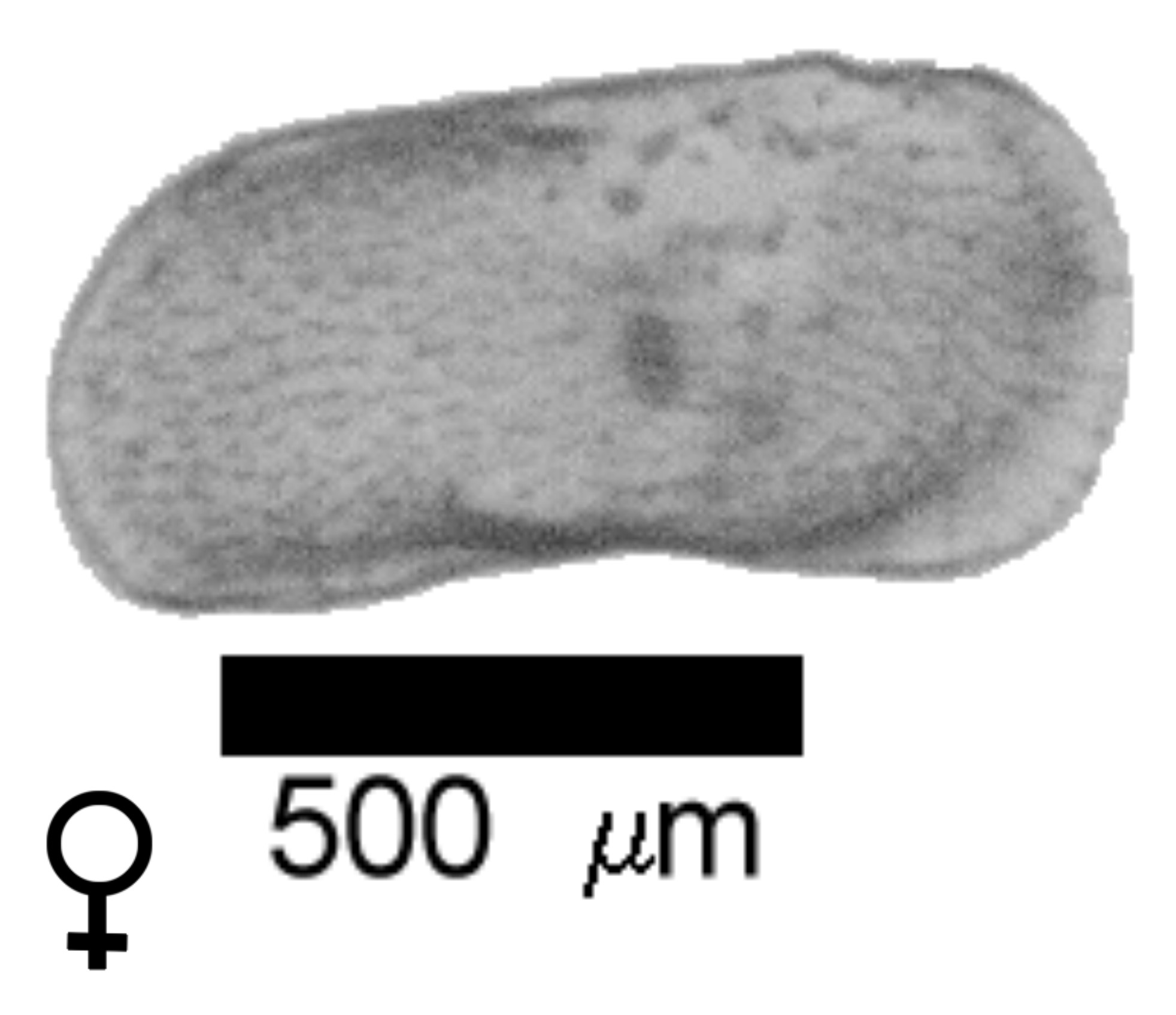 Microscope photograph of Limitas, female